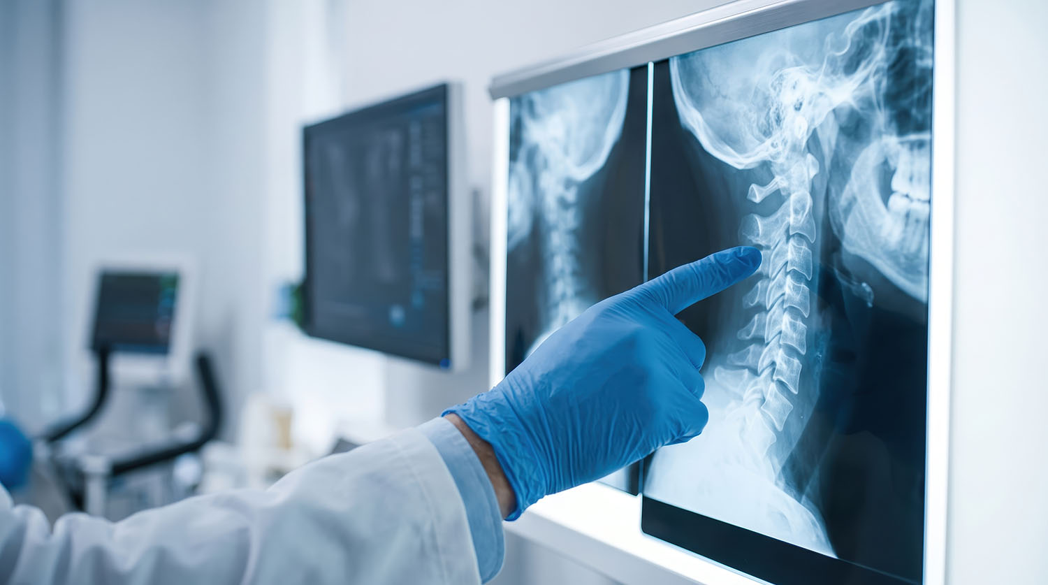 Medical professional wearing blue gloves examines orthopedic xray of cervical spine in radiology room with digital monitors and medical equipment in background AdobeStock 2148927811